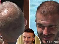 唏嘘！46岁贝克汉姆亮相：秃顶 头发花白 满脸皱纹，老到认不出了