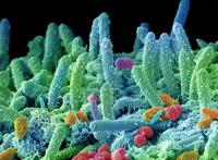 如果将地球微生物带到火星，能否改造火星环境？