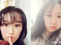 一个罕见病「渣女」的纯情罗曼史