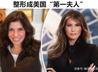 细数世界上将自己“疯狂”整形成偶像模样的5个人