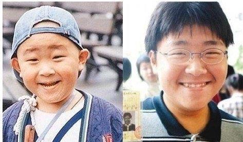 昔日童星基本变样，现在竟然都长残？