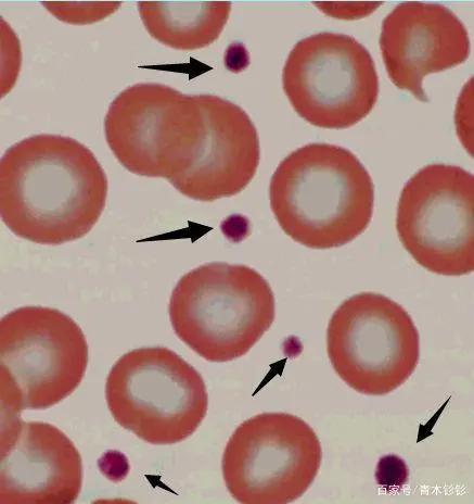 难得一见的科普类动漫——《工作细胞》