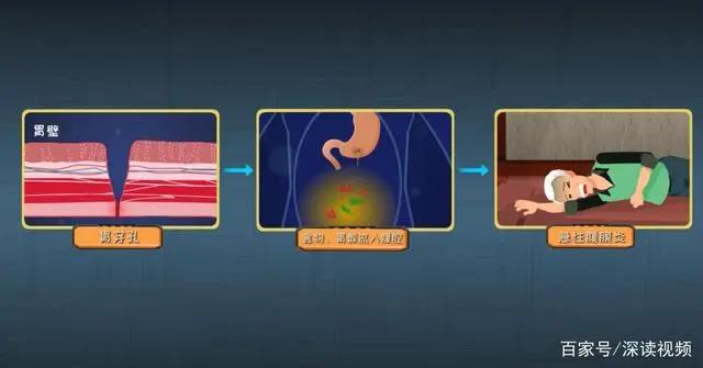 紧张焦虑，过量饮酒能导致胃溃疡？硬核动漫《胃溃疡的来历》