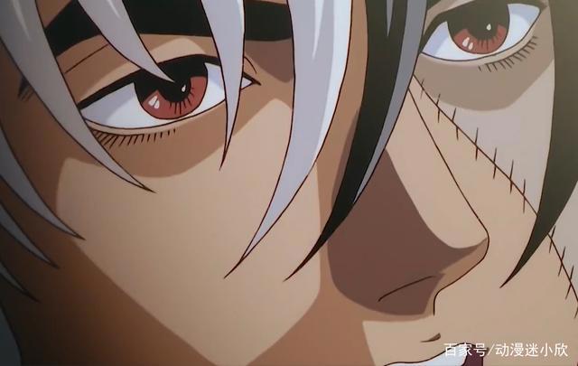 《怪医黑杰克》：62岁老头强娶16岁公主，公主服毒，不料长出鳞片