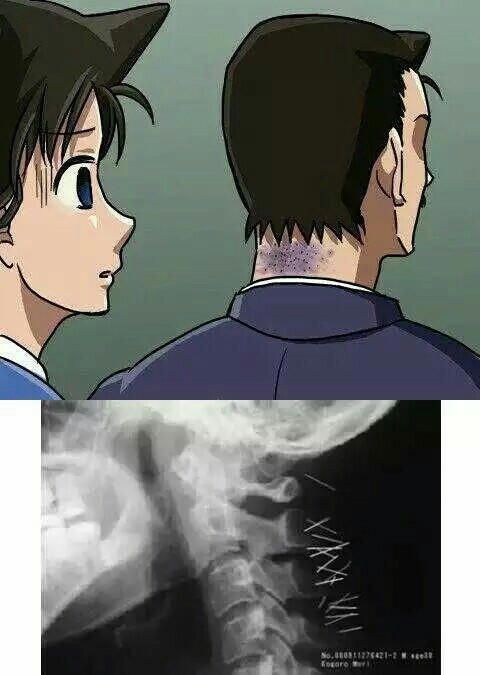 其实毛利小五郎一直都是深藏不漏的，从这些看方面你就懂了