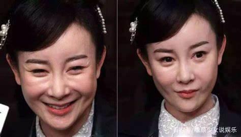 从圆脸到锥子脸再到高级脸，近20年娱乐圈审美是怎么跑偏的？