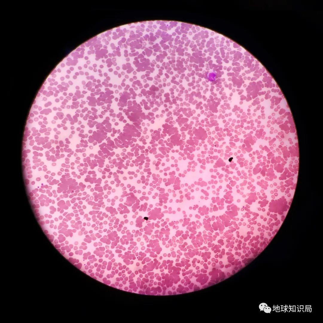 你的血型与性格、智商、社会地位，真的有关系么？