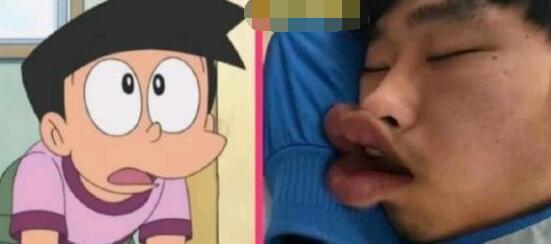 《哆啦A梦》拍真人版评分：小夫颜值给1分，大雄给5分，静香满分