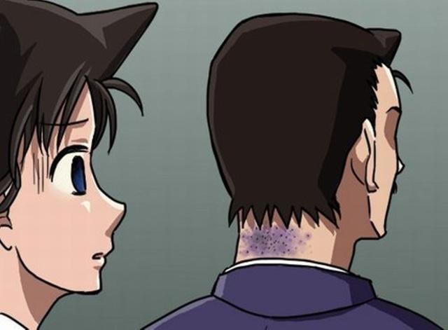 毛利小五郎被麻醉这么多次会怎样？麻醉医师：死定了！