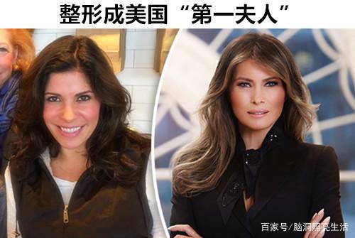 细数世界上将自己“疯狂”整形成偶像模样的5个人