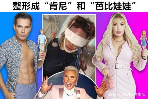 细数世界上将自己“疯狂”整形成偶像模样的5个人