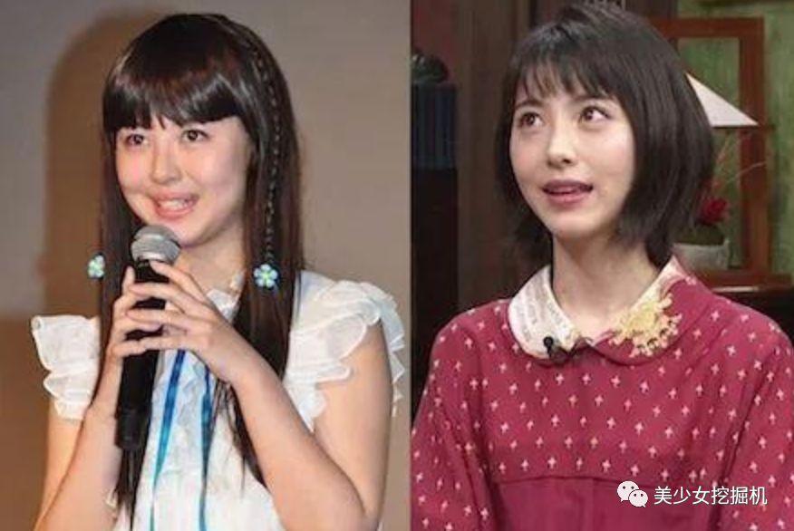 为出演真人漫改女主爆瘦24斤依旧被喷，婴儿肥变瓜子脸攻性太强？